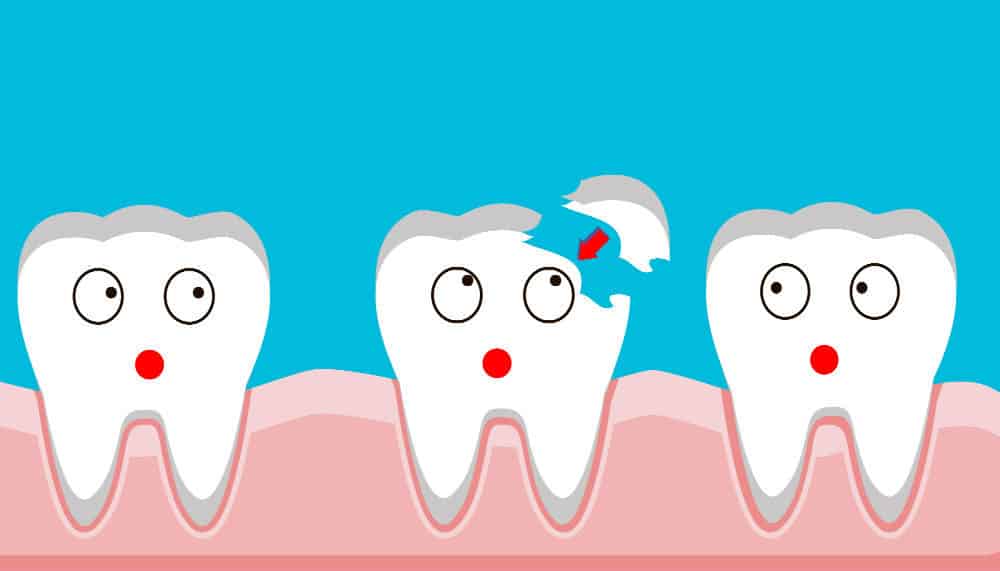 Лечение отколовшихся и сломанных зубов