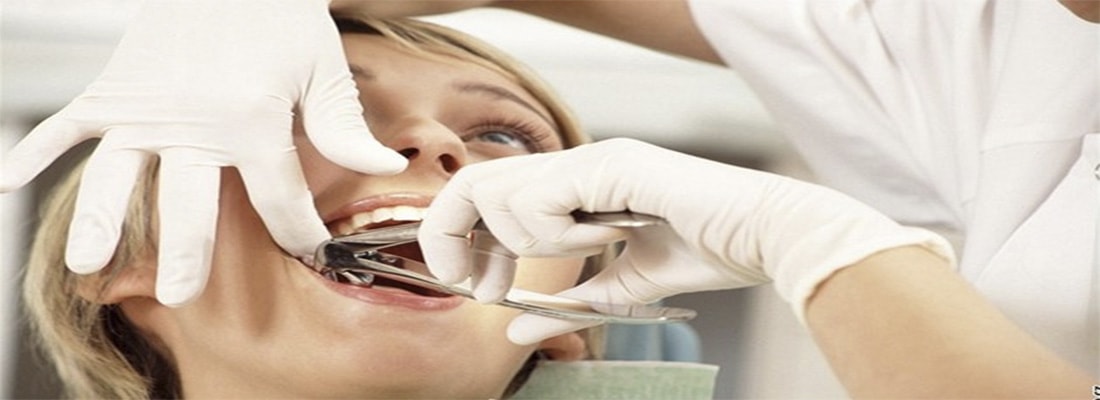 Причины удаления зубов