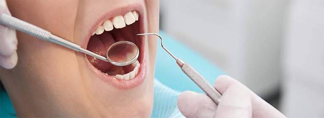 Сколько стоит пломбирование зубов
